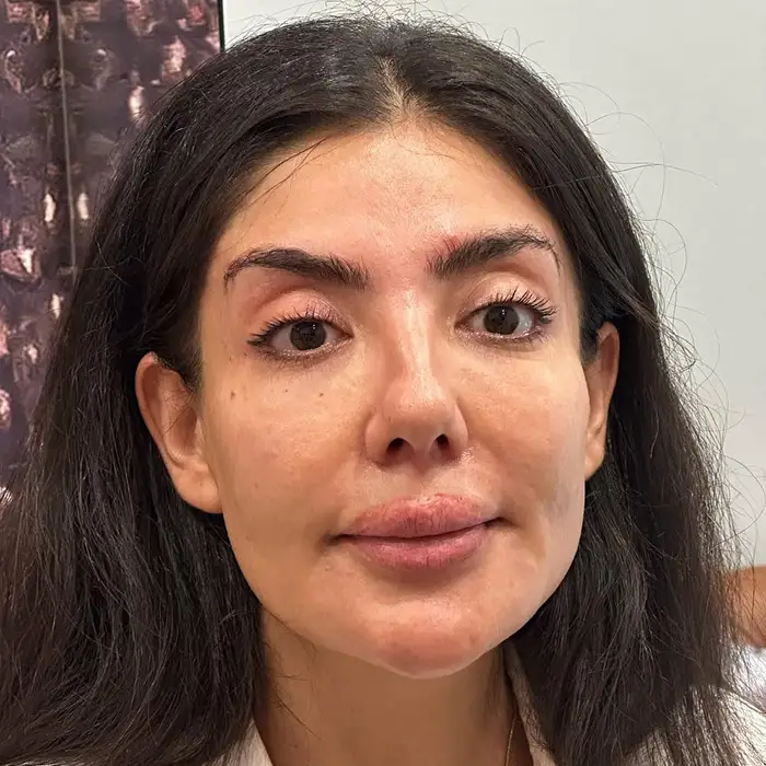 bridal makeup artist istanbul before photo model 1