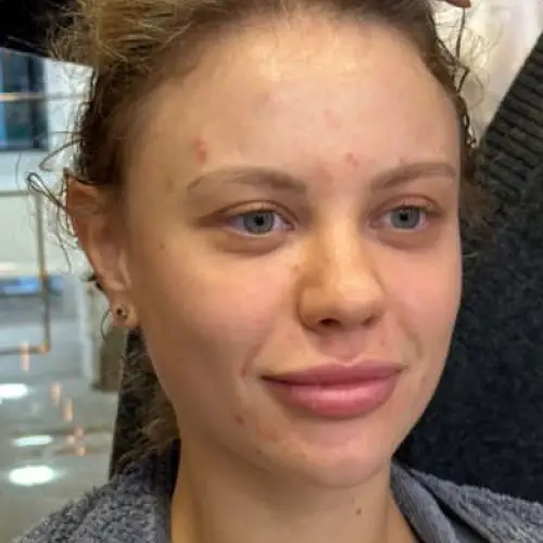 makeup artist istanbul before photo model 1